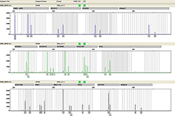 苏州血缘检测医院查询,苏州医院DNA鉴定准确吗 苏州血缘检测医院查询,苏州医院DNA鉴定准确吗